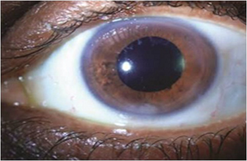 rishinethralaya.org